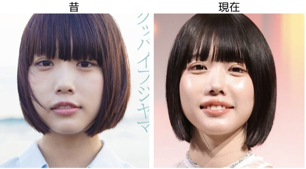 あのちゃんと昔と現在の写真