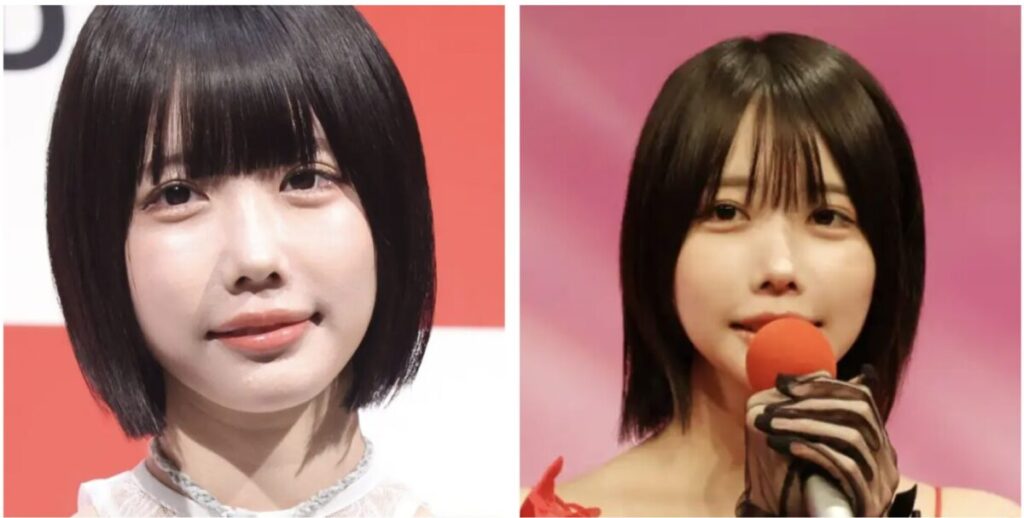 あのちゃんの正面からの画像