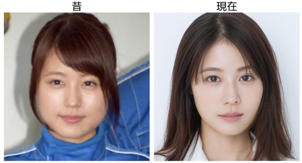 有村架純の昔と現在の比較画像