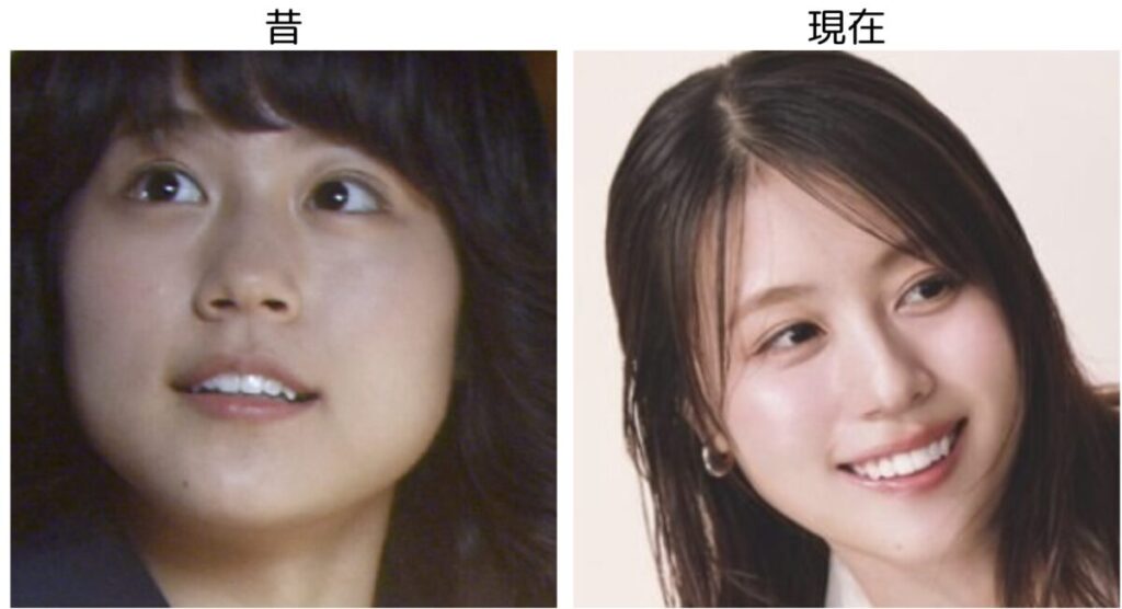 有村架純の昔と現在の比較画像３