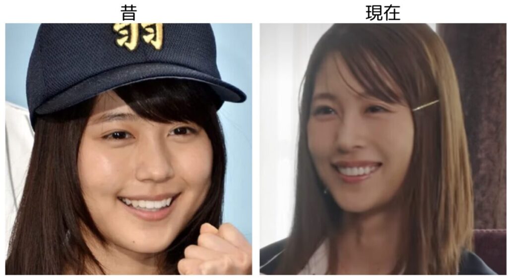 有村架純の昔と現在の比較画像４