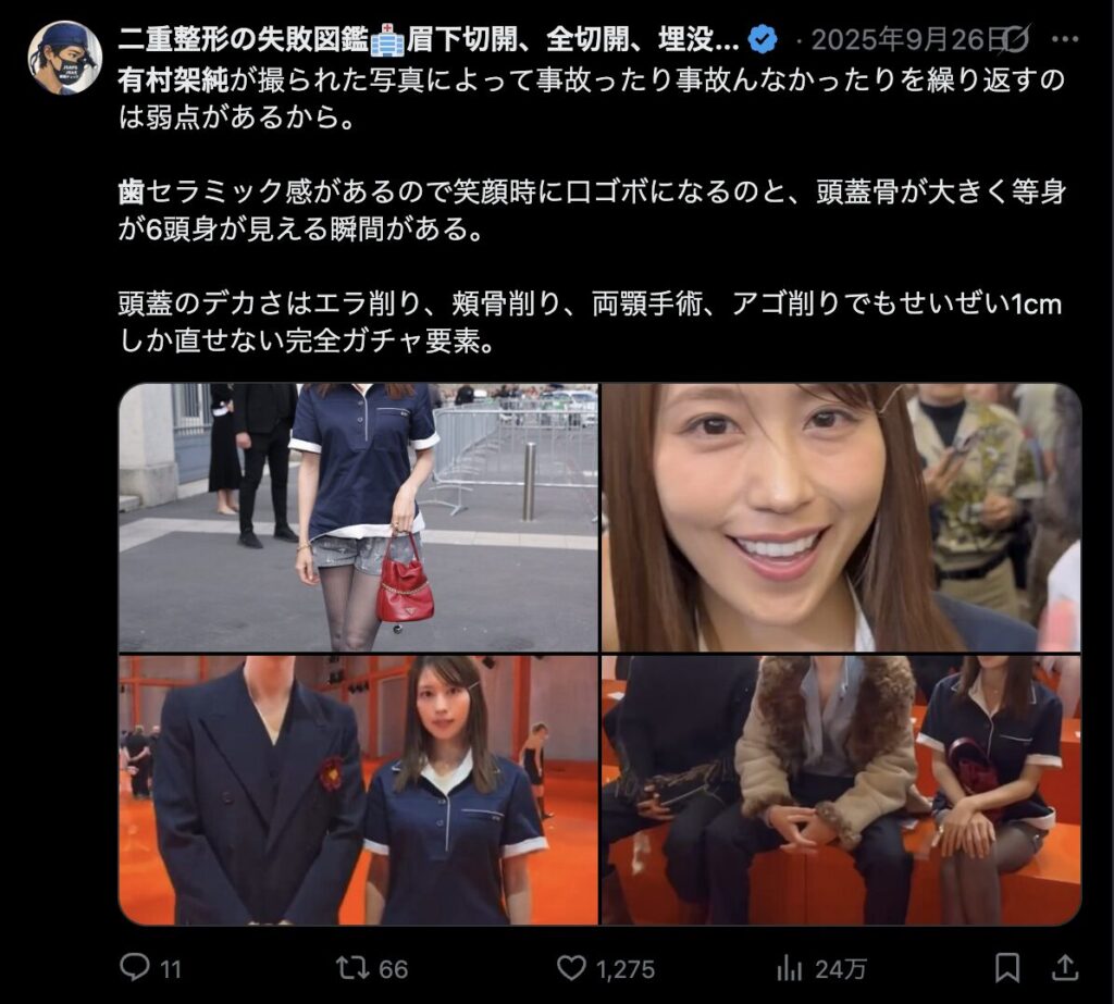 有村架純の歯に関するXのコメント8