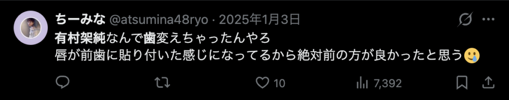 有村架純の歯に関するXのコメント2