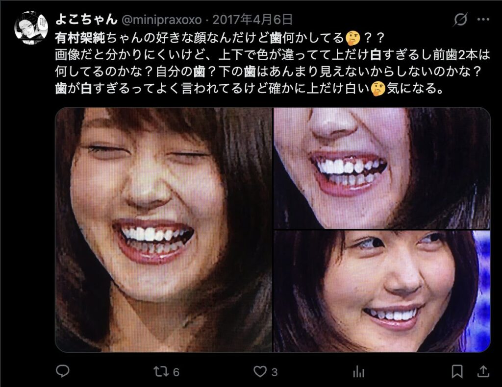 有村架純の歯に関するXのコメント9