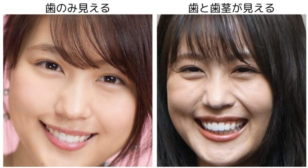 有村架純の比較画像4