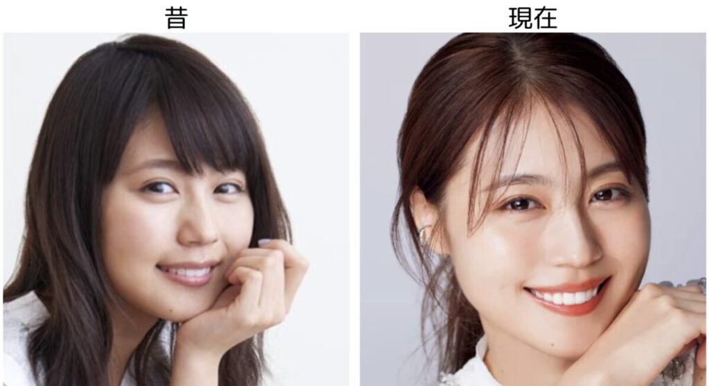 有村架純の比較画像3