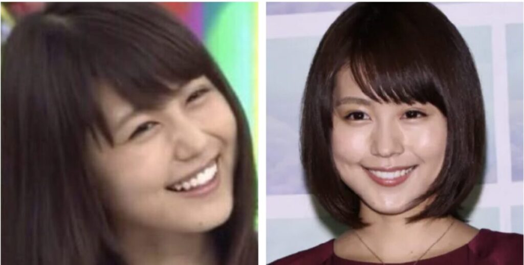 有村架純の昔の写真