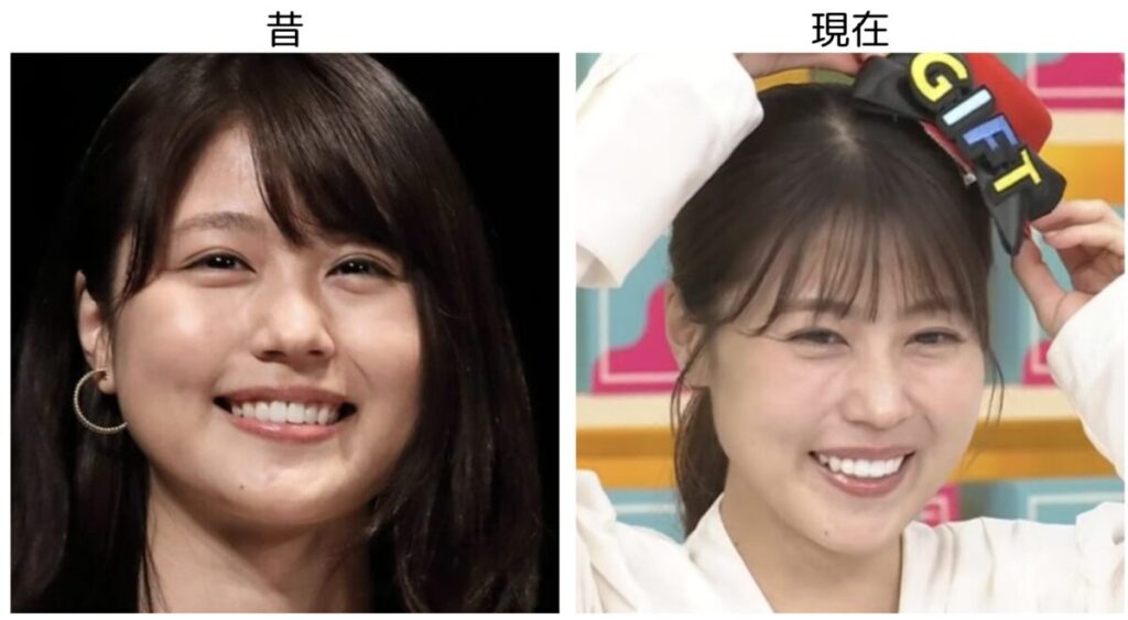 有村架純の笑顔の比較３