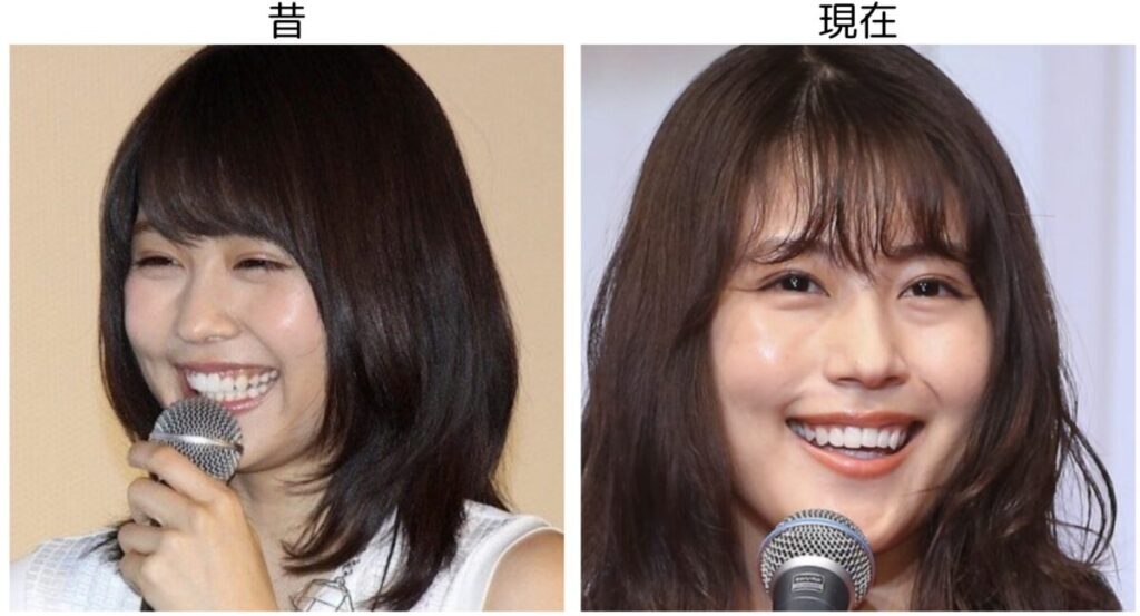 有村架純の笑顔の比較４