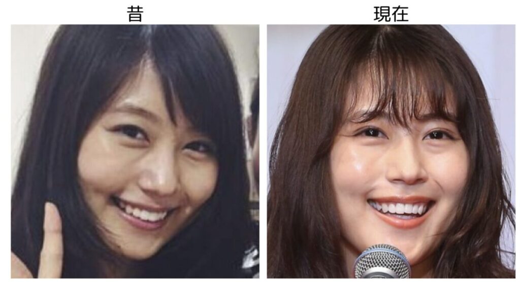 有村架純の昔と現在の比較画像２