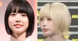 あのちゃんの鼻の形を画像比較で検証｜上向きに見える角度や不自然と言われる理由に注目